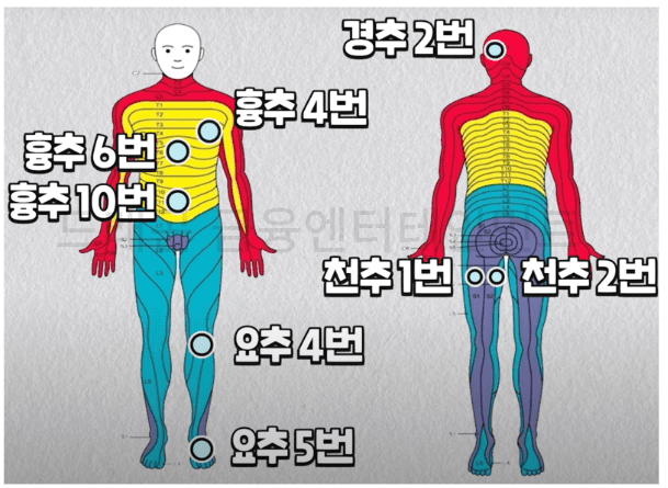 흉추4번 흉추6번 흉추10번 요추4번 요추5번 경추2번 천추1번 천추2번