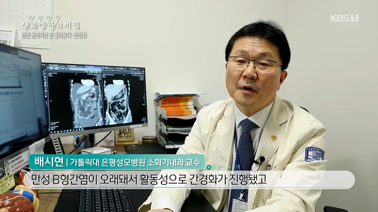생로병사의 비밀.E863.230406p.H264-F1RST.mp4_20230406_202718.949.jpg