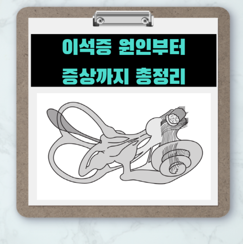  어지럼증 유발 하는 '이석증' 원인과 치료법