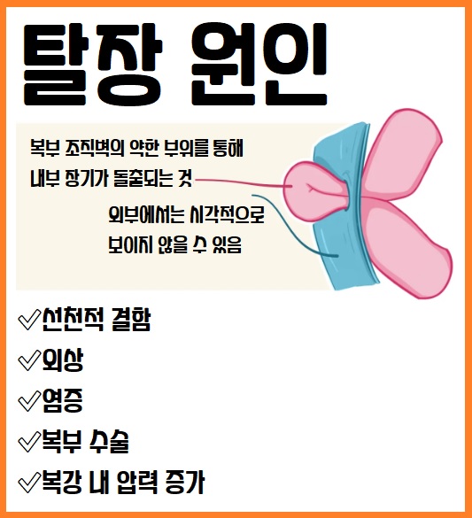 탈장 완전 가이드: 증상부터 수술까지