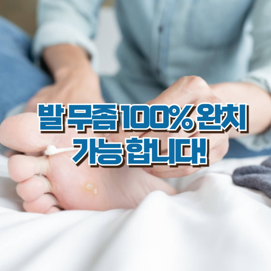 무좀약 추천