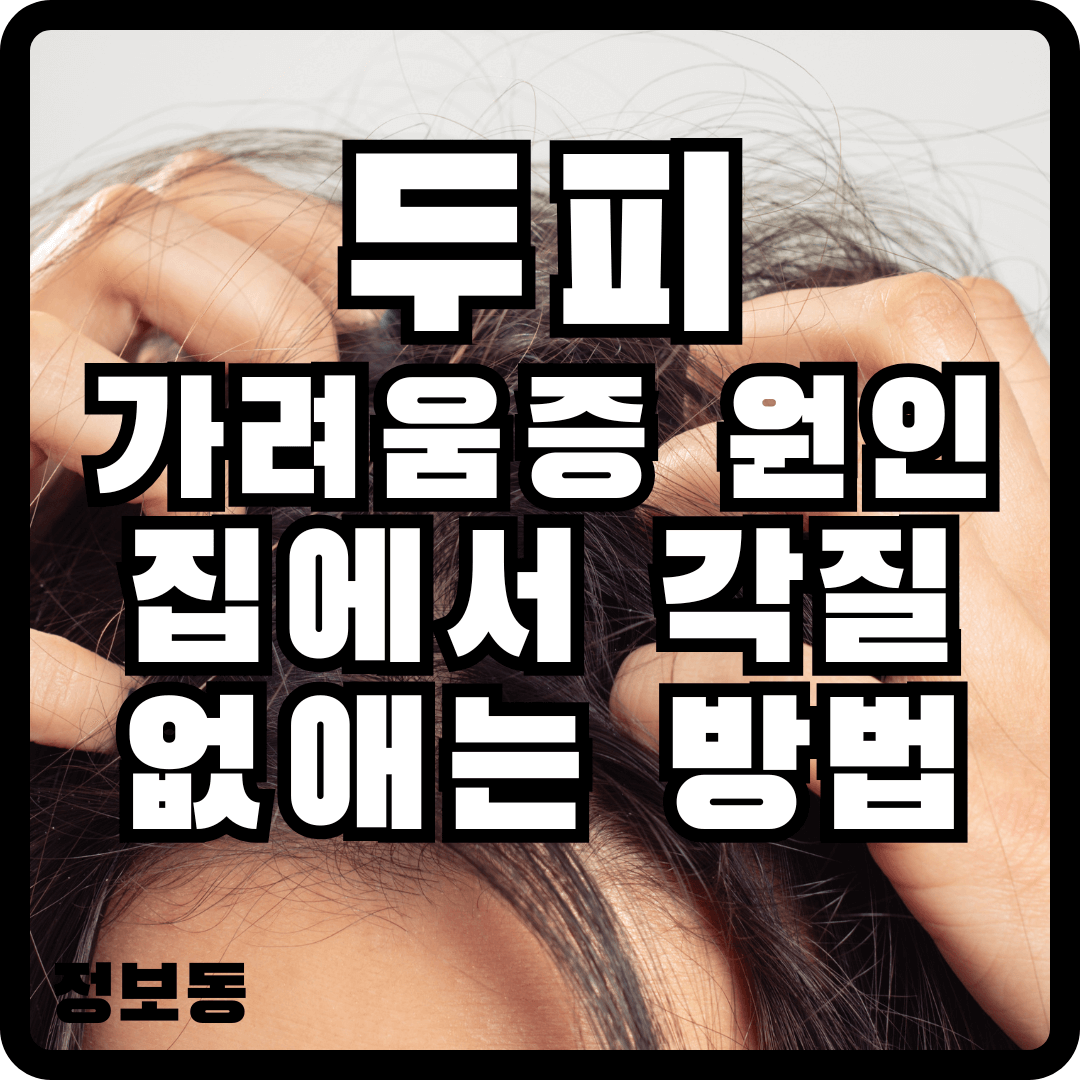 두피 가려움증 원인 각질 없애는 방법