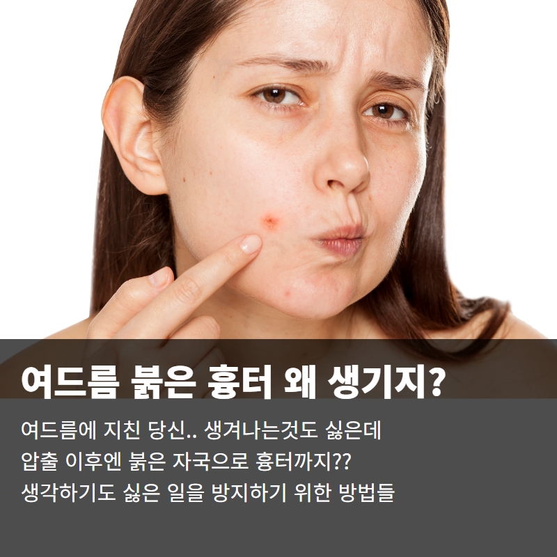  여드름 흉터인 붉은 자국 왜 생기는 것일까??