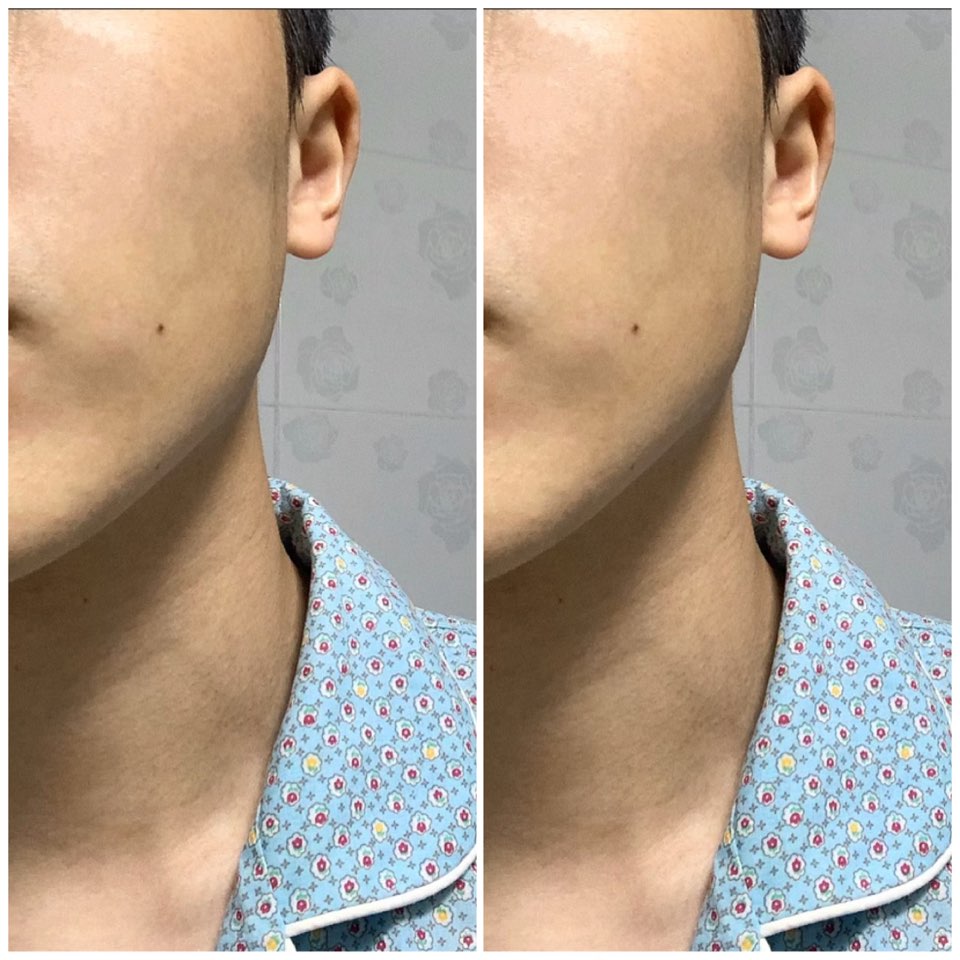  프리메라 필링젤 얼굴 각질 제거에 최고! (각질 주의!!)