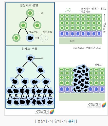 암이란 종양