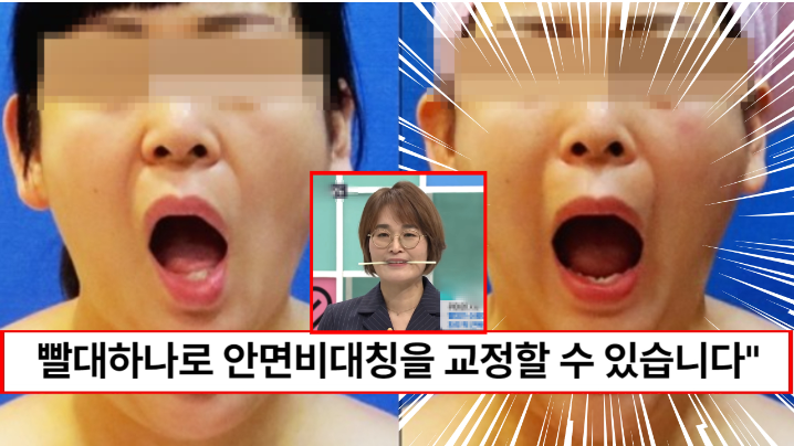 “빨대 하나면 비대칭이 교정됩니다” 한 번만 따라해도 바로 효과가 나타나는 빨대 안면비대칭 교정 방법 “빨대 하나면 비대칭이 교정됩니다” 한 번만 따라해도 바로 효과가 나타나는 빨대 안면비대칭 교정 방법