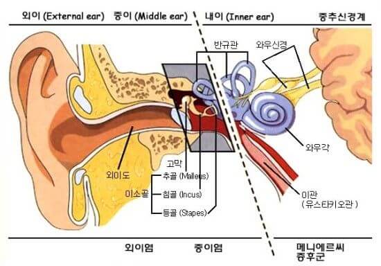 메니에르병 증상