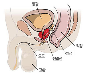  전립샘암 원인 좋은 음식 추천 안좋은 것들까지 총정리
