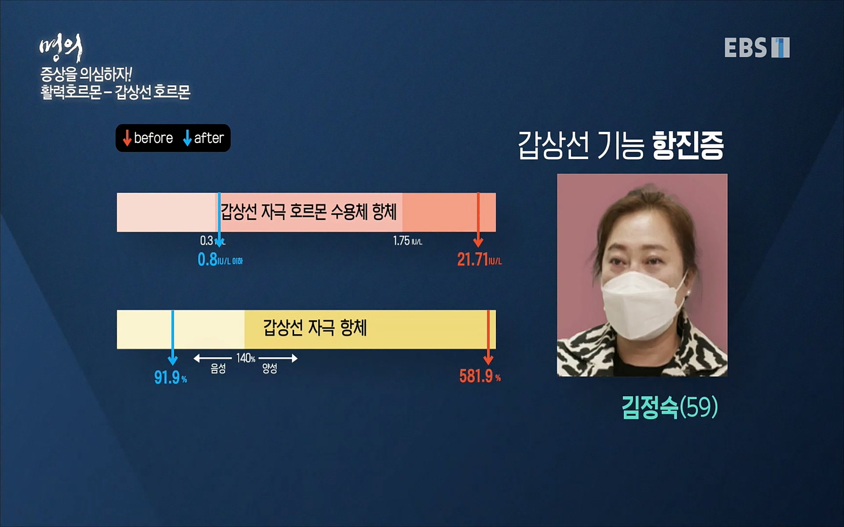 EBS 명의 헬스케어 - TV - 교육의 중심 EBS내 몸을 지배하는 7가지 호르몬 2부, 증상을 의심하자!.mp4_20220711_200209.228.jpg