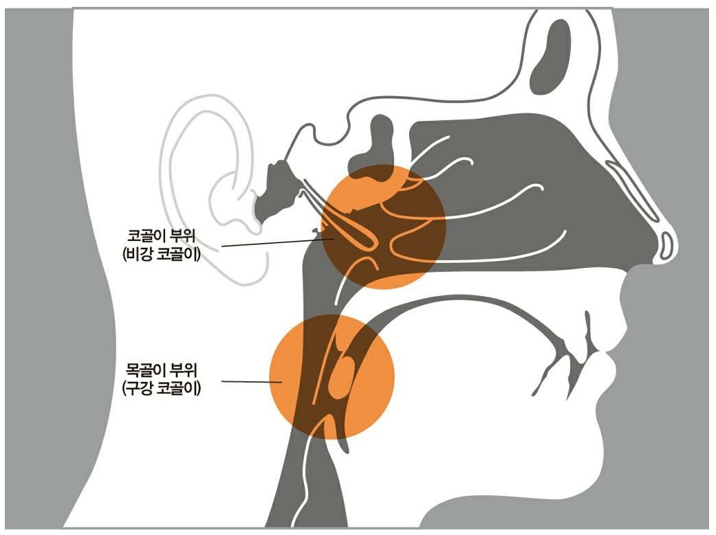  목감기, 코막힘 - 수술, 침 치료?