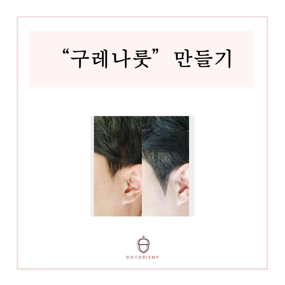  구레나룻 이제 부산 두피문신 도토리SMP 에서 만드세요!!