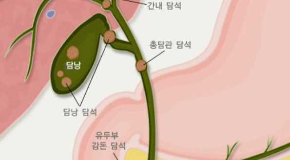 왼쪽 갈비뼈 아래 통증