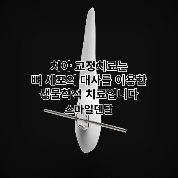 치아-교정치료-썸네일