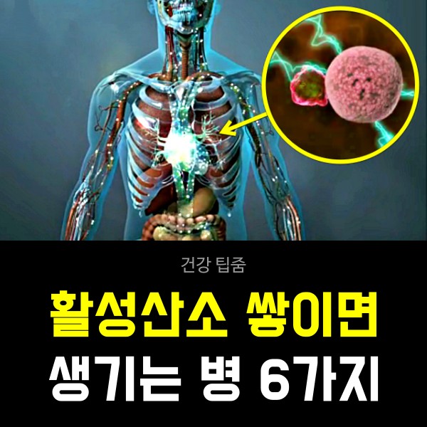 활성산소 심장마비 뇌졸중 동맥경화, 항산화물질, 건강 팁줌 매일꿀정보