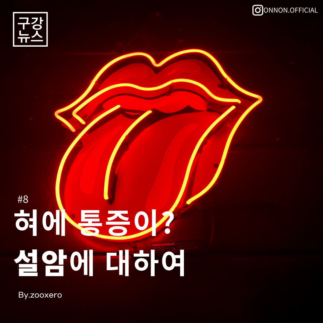  [구강정보] #9 혀에 통증이? 설암에 대하여