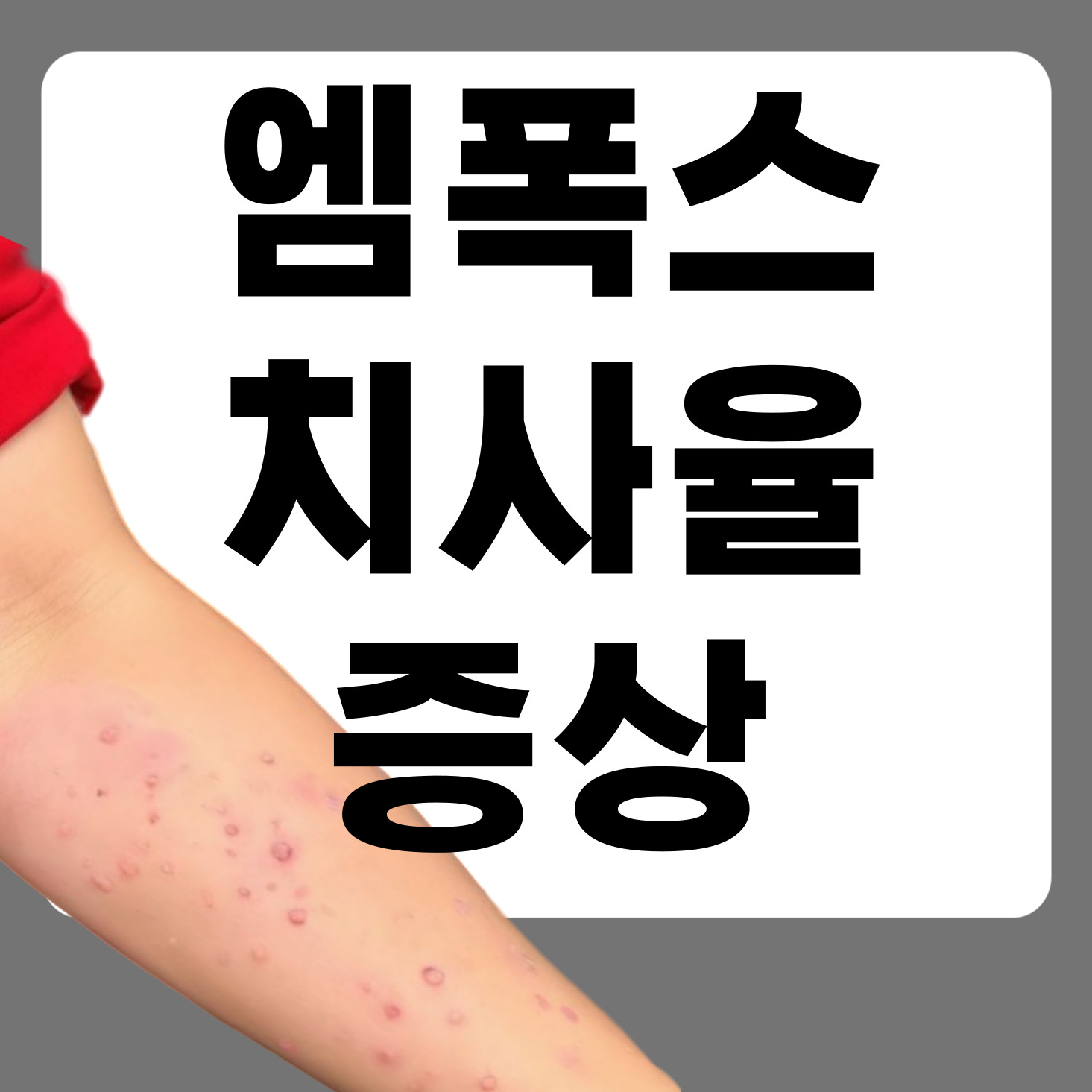 엠폭스_원숭이_두창_원인_증상_치사율_전염_감염경로
