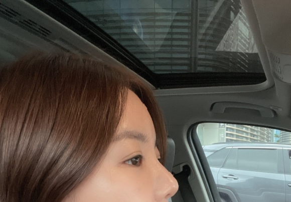 이마필러잘하는곳 후기! 9