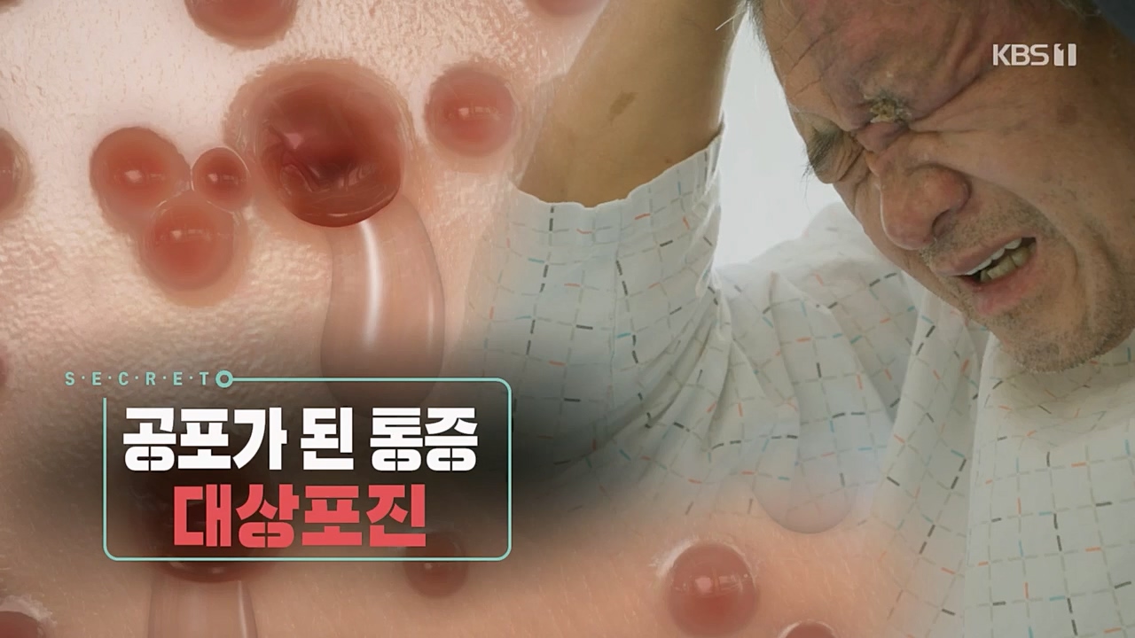 생로병사의 비밀.E857.230223p.H264-F1RST.mp4_20230223_202242.243.jpg