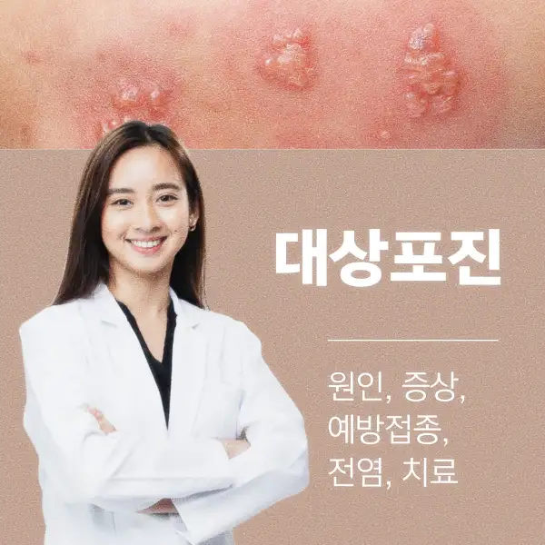 대상포진 원인&amp;#44; 증상&amp;#44; 예방접종&amp;#44; 전염&amp;#44; 치료