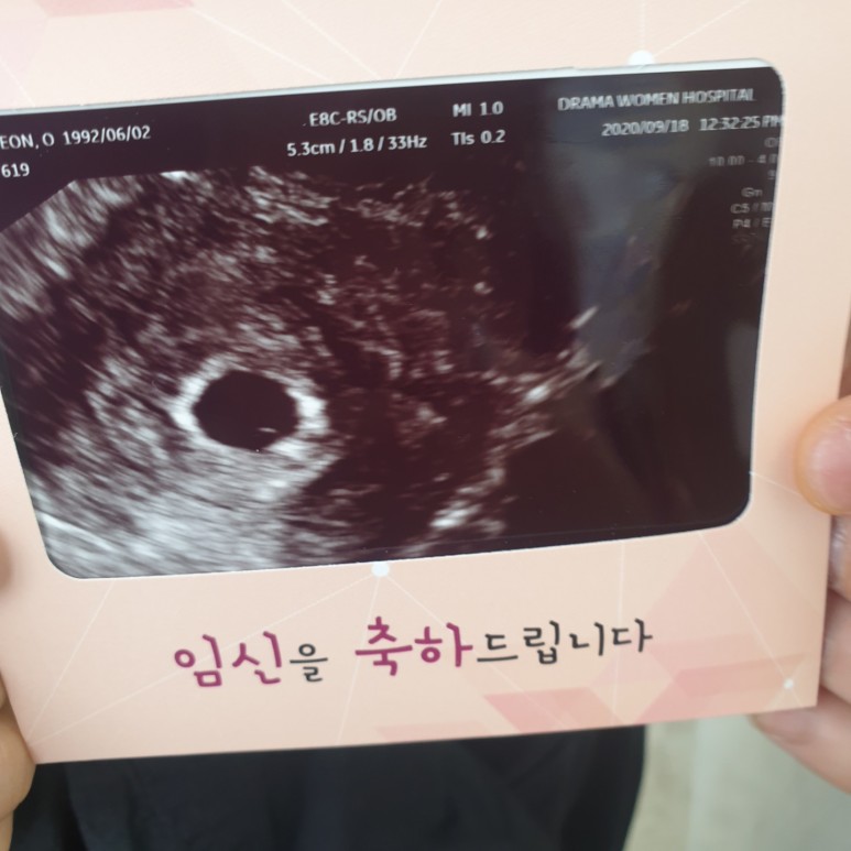 첫임신!임신5주차,임신전후 9
