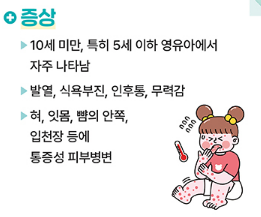 수족구병 예방과 치료 여름철 아이 건강 관리
