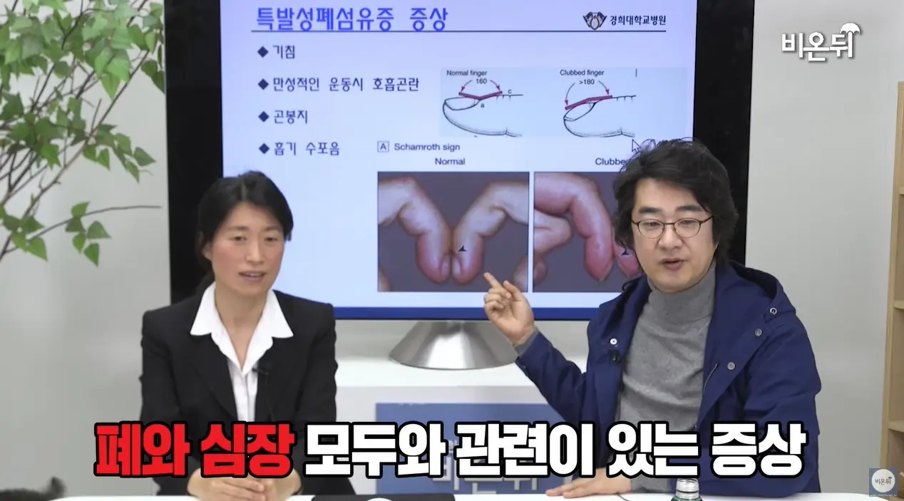 곤봉지가 있으면 폐암 확률이 높다 자가검진 방법 알기