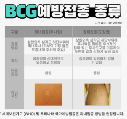결핵예방접종
