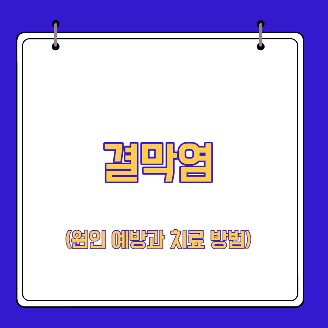 결막염 증상 원인 예방과 치료 방법