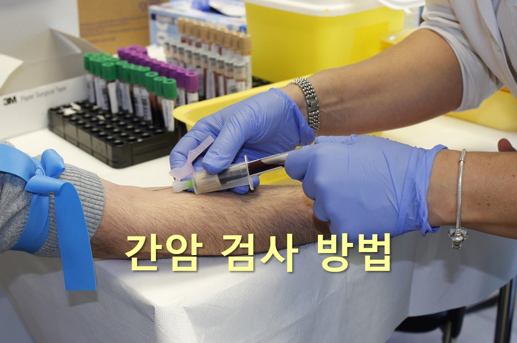  간세포에 생기는 암을 진단하는 간암 검사 방법