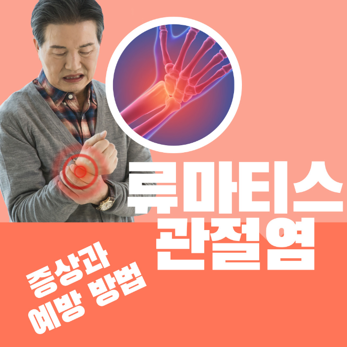 류마티스 관절염 증상, 예방 방법 알아보기