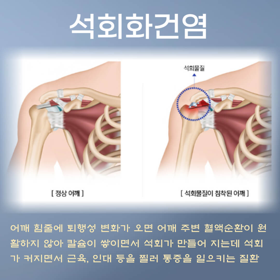 석회화건염