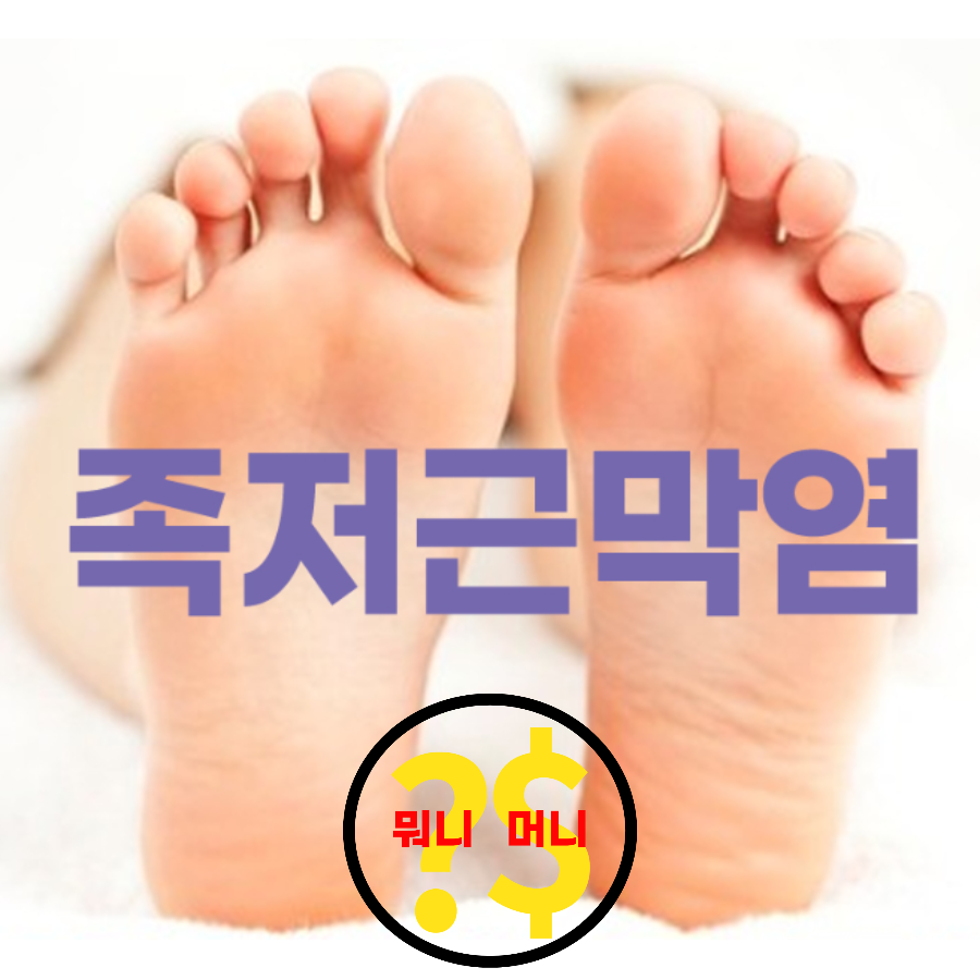  족저근막염의 이해 및 치료: 발 통증 완화 가이드 (교수추천까지)