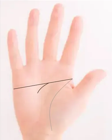 일자손금에 하향하는 가지선