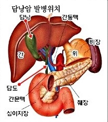  별견되면 말기일 확률이 높은 담도암 원인 및 증상 치료 방법 입니다.