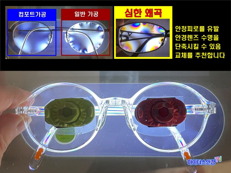 (다초점렌즈 착용불가 경우) 돋보기 해결 ... ㅇㄱㅁㅎ 양안백내장 수술 후 교정시력 확보가 어려운 경우