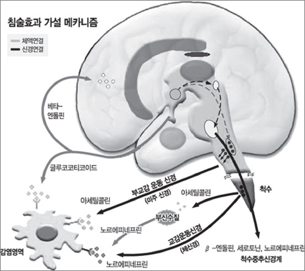 한국침술연합회 이미지