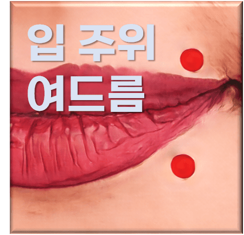  입주위 여드름 원인부터 해결 방법까지
