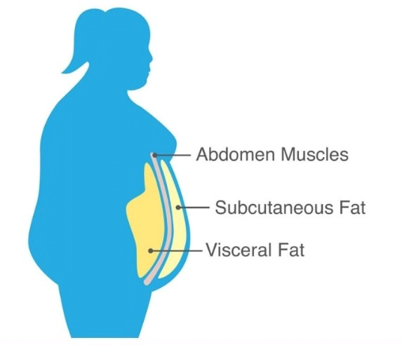 내장지방 빼는 운동 4가지 