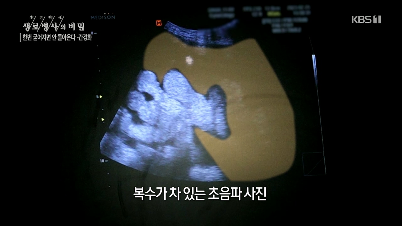 생로병사의 비밀.E863.230406p.H264-F1RST.mp4_20230406_202713.982.jpg