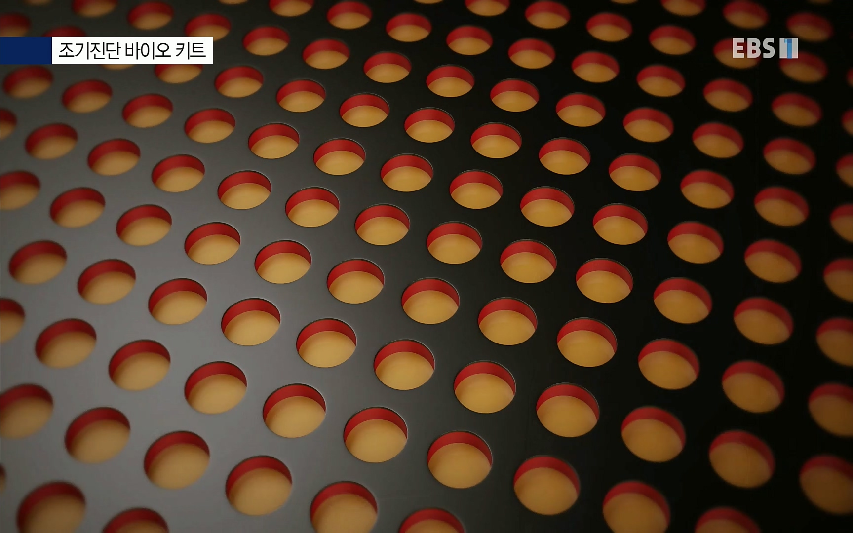 EBS 명의 헬스케어 - TV - 교육의 중심 EBS[명의 스페셜] 공포의 암, 췌장암, 담도암, 담낭암.mp4_20220902_210916.118.jpg