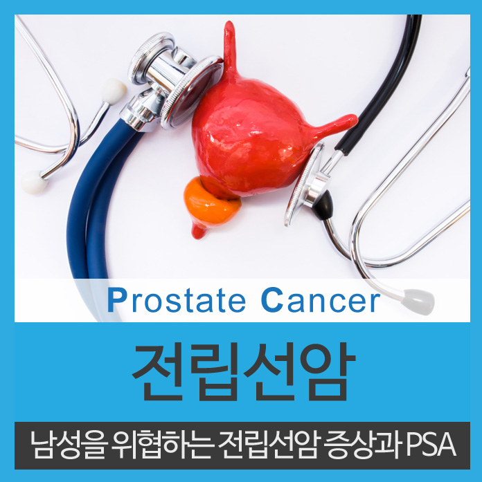  전립선암 증상 주의해서 관리해야 합니다