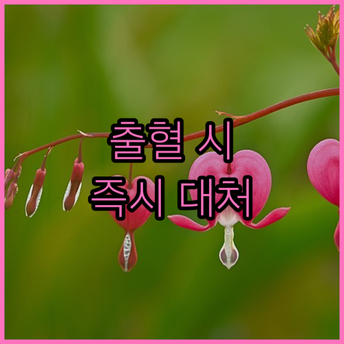 생명을 살리는 응급처치: 출혈 발생 