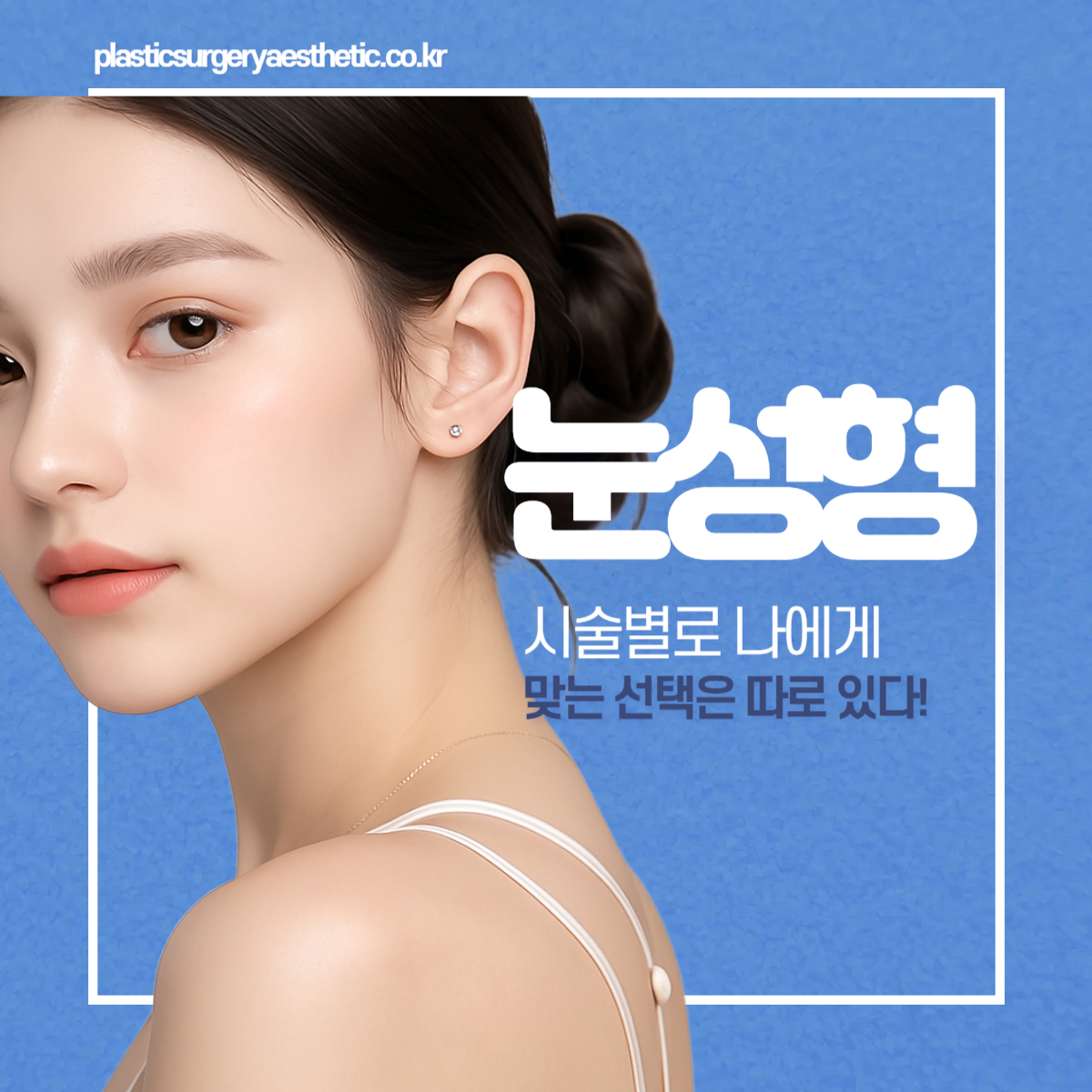 눈성형, 시술별로 나에게 맞는 선택은 따로 있다