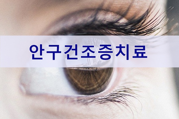  안구건조증치료와 인공눈물사용과 관리법
