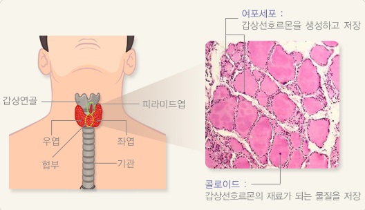  갑상선 결절이란 무엇인가? 원인 증상 진단 및 검사 치료법 예방 방법 알아보기