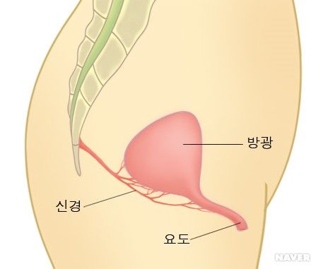 과민성 방광 치료방법 원인과 수술 증상