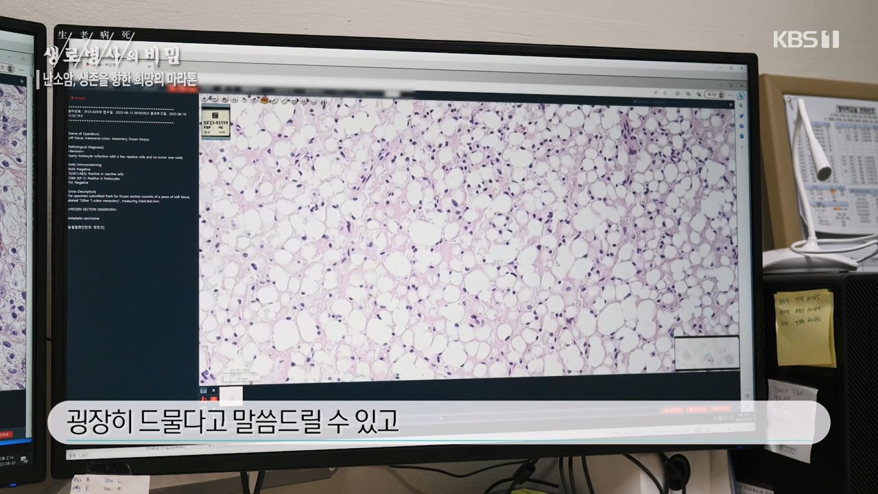 생로병사의 비밀.E878.230803p-NEXT.mp4_20230805_155633.877.jpg