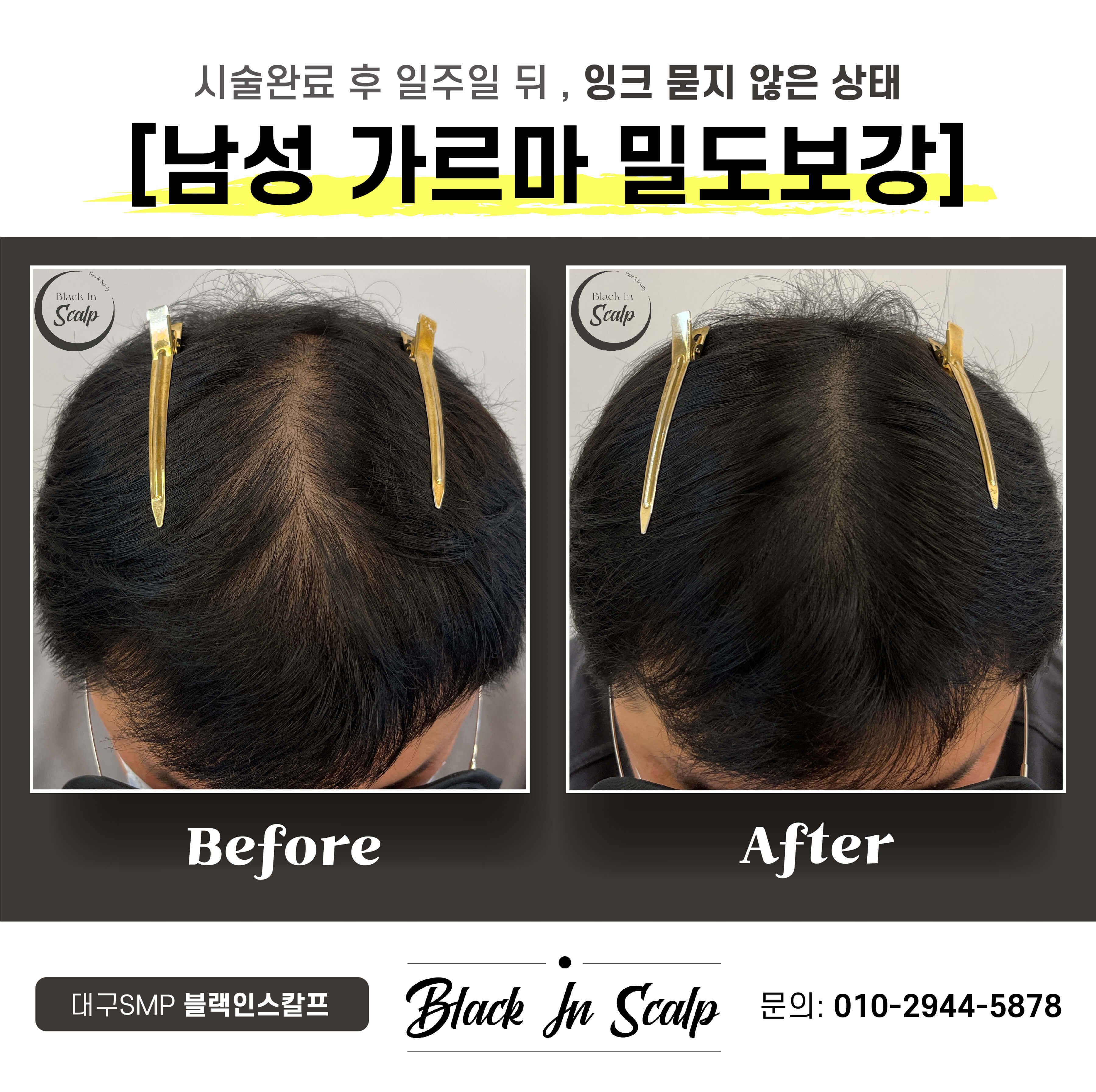 블랙인스칼프 이미지