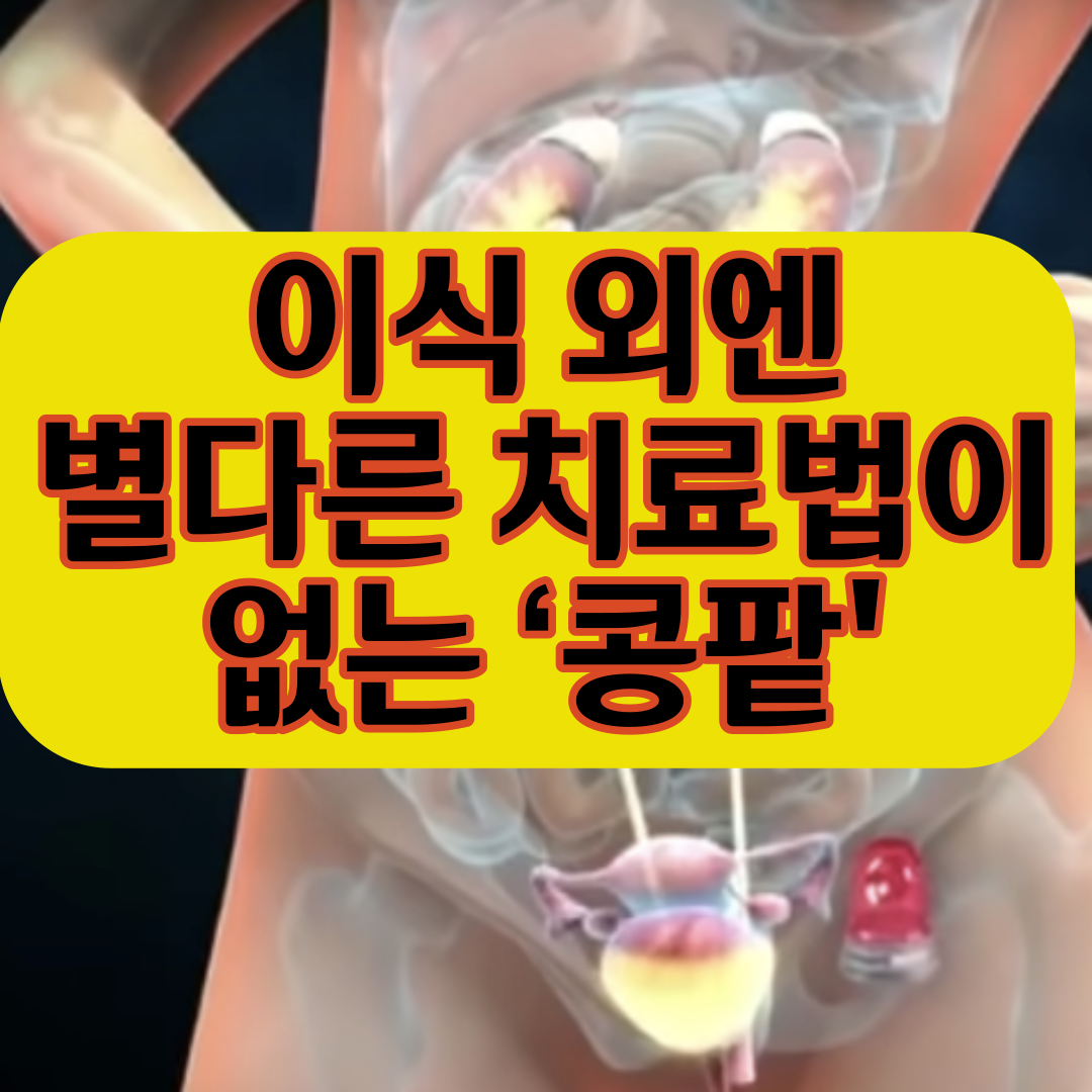  콩팥 건강을 지키는 명약은? 소변을 오래 참으면 병이 된다고 하는데 진실은 과연