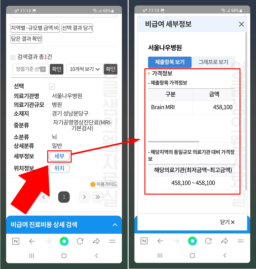  병원 비급여 진료비 정보 확인 방법: 입원비 MRI 물리치료 비용 등